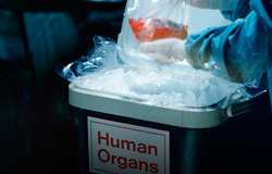 organ-trafficking